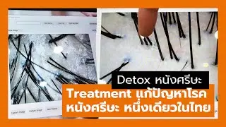 Detox หนังศรีษะและตรวจเช็คสุขภาพผม โดยผู้เชี่ยวชาญ เห็นชัดทุกรูขุมขน 1 เดียวในไทย #bikbenlee