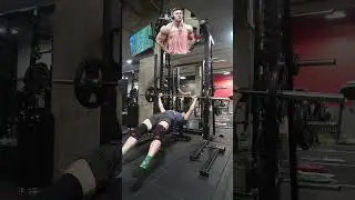 “I have natural gyno.. that sucks” 🍋🥲