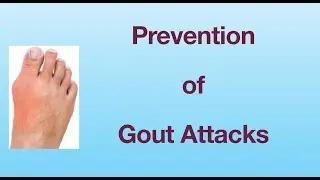 Gout prevention