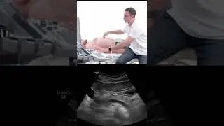 Identifying #pancreas  Structures on #ultrasound #shorts