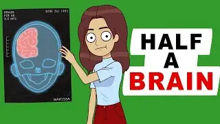 My Life With Half A Brain