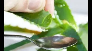Aloe Vera For Dandruff