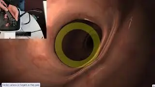 EndoSim Fundamental Endoscopy Skills 1: Knob Handling with Hand Coordination