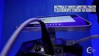 Радиочестотен лифтинг с Morpheus8