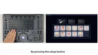 Why Buy SonoScape A6V Expert E1V | Affordable Black & White Ultrasound Machine | KeeboVet