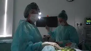 Септоплатиска, вазотомия, эндоскопическая шейверная аденотомия