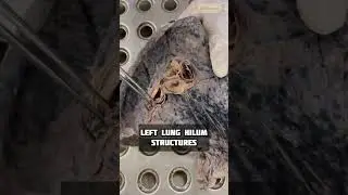 Left lung Hilum Structures #4 | Anatomy Thorax | #mbbs #neet #viral #shorts #shortfeed