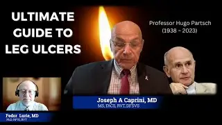Ultimate Guide to Leg Ulcers: Treatment Strategies for Patients and Physicians