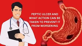 PEPTIC ULCER AND WHAT ACTION CAN BE TAKEN TO PREVENT IT FROM WORSENING #pepticulcer #indigestion