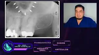 Repesando la anatomía  radiográfica de cavidad oral