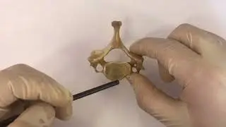 Седьмой шейный позвонок - Vertebra Prominens