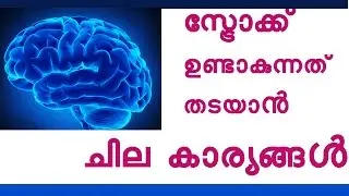 സ്ട്രോക്ക് ഉണ്ടാകുന്നത് തടയാൻ ചില കാര്യങ്ങൾ Stroke Prevention Lifestyle Tips