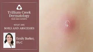 What are Boils and Abscesses?