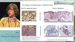 Gastric carcinogenesis of gastric cancer through the eyes of a pathologist