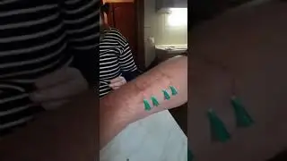 Феномен Самогипноза Анестезия 