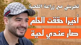 تجربتي مع زراعة اللحية بعد 5 أشهر | زراعة ذقن سفيان