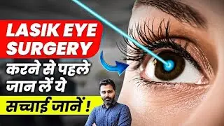 LASIK Eye Surgery करने से पहले जान लें ये सच्चाई जानें ! | Benefits & Side Affect Of Lasik Surgery