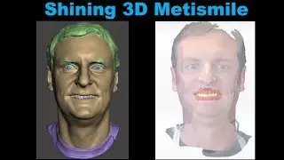 First Time Scanning with the Shining 3d Metismile Facial Scanner