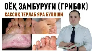 ОЁҚ САССИҚ ТЕРЛАБ ЗАМБУРУҒ ЯРА БЎЛИШИ ВА ДАВО ЧОРАЛАРИ ҲАҚИДА МАЪЛУМОТ / Исчанов