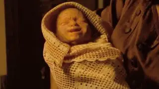 EL único niño nacido en el mundo siendo un anciano pero