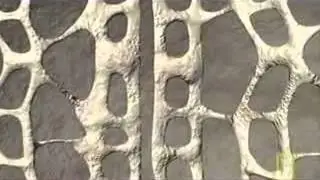 Bone Remodeling