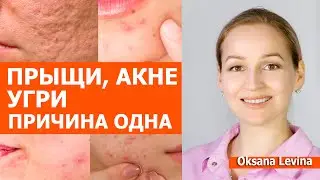 Прыщи, угри и акне все дело в еде. Как еда влияет на прыщи.