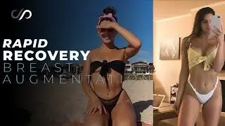 I Got a Breast Augmentation Surgery and Here's What Happened