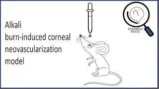 Alkali burn-induced corneal neovascularization model | Disease Induction method