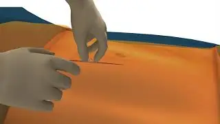 3M™ Ioban™ 2 Antimicrobial Incise Drape