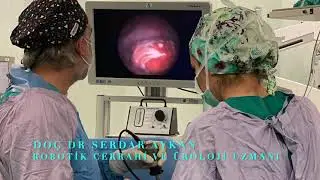 ÜRETRA TAŞI, MESANE TAŞI  HİKAYEMİZ, SİSTOLİTOTRİPSİ. DOÇ DR SERDAR AYKAN