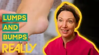 Dr. Emma Treats Man With Lumps And Bumps On His Arm and Legs! | The Bad Skin Clinic