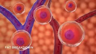 Emsculpt Neo® animation video - Florida Plastic Surgery Group - Jacksonville, FL