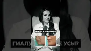 Гиалуроновые Усы- то чего бояться многие при увеличении! #косметологиямосква #клиникакосметологии