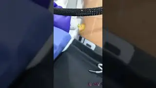 Full Body Laser Hair Removal 