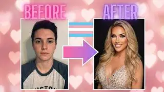 Transgender Before & After: Trans Estrogen's Dramatic Effects