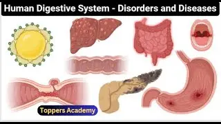 Digestive disorders | part 4 #toppersacademy #ppsc #spsc #fpsc #sst #lecturertest #neet #biologymcqs
