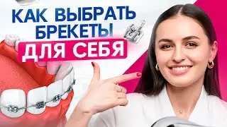 3 совета по выбору брекетов от стоматолога. Как выбрать ЛУЧШЕЕ для себя?