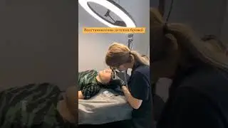 Алопеция. Татуаж детских бровей. 
