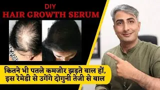 घर पर हल्के बालों को करें घना बनाइये। DIY Thick Hair Growth Serum I DR, MANOJ DAS