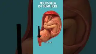 Mucus Plug Becomes Bloody Show 