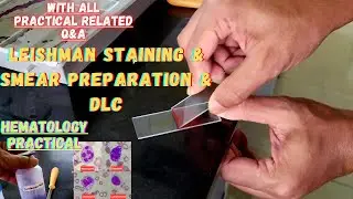 Leishman Stain Procedure and Blood Smear Preparation for DLC Count