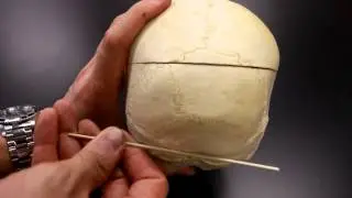 SKELETAL SYSTEM ANATOMY: Posterior aspect of the human skull