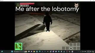 Me after the lobotomy