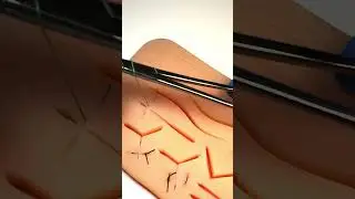 Хочу быть хирургом, но не знаю с чего начать | Тренажер Scalpel med