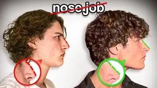 I Spent 2 Years Fixing My Nose Naturally | 3-Step Guide