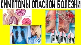 НЕ ПРОПУСТИ ЭТИ СИМПТОМЫ | Симптомы опасных заболеваний которые мы часто не замечаем