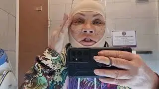Моя пластическая операция . ШЕСТОЙ ДЕНЬ  с Докфайндеркорея в клинике View Plastic Surgery Korea