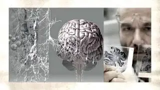 Почему мы не живём 150 лет?