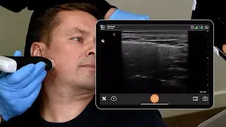 Ultrasound of the Male Jawline