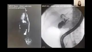ACT ASM Free Paper presentation – Dr Xi Yin Goai